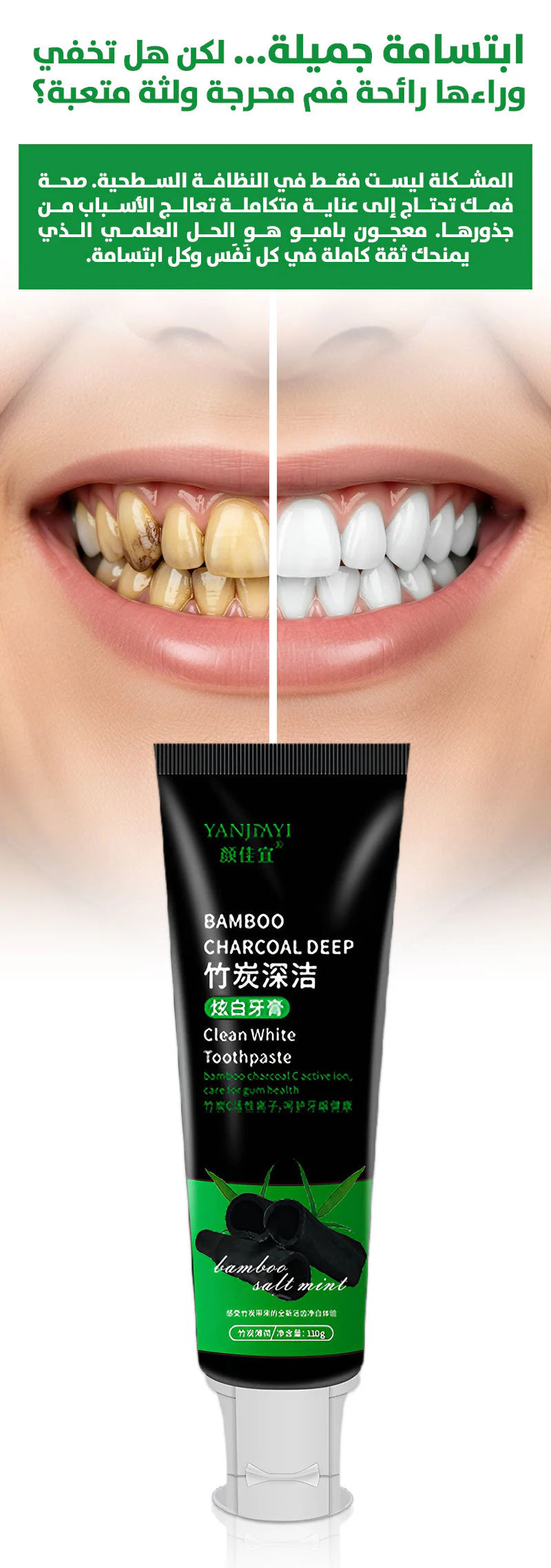 معجون أسنان YANJIMI لتبييض وتنظيف عميق