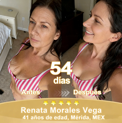 Certificación oficial 💎 𝐂𝐔𝐑𝐄𝐕𝐈𝐕𝐎® Crema reparadora dual con células madre de arroz negro